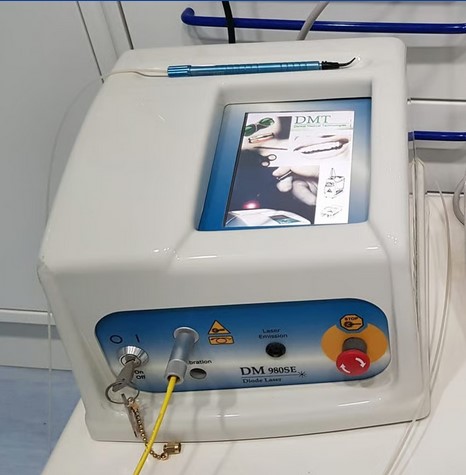 Laser odontoiatrico