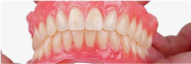 Endodonzia e protesi - Studio Froio
